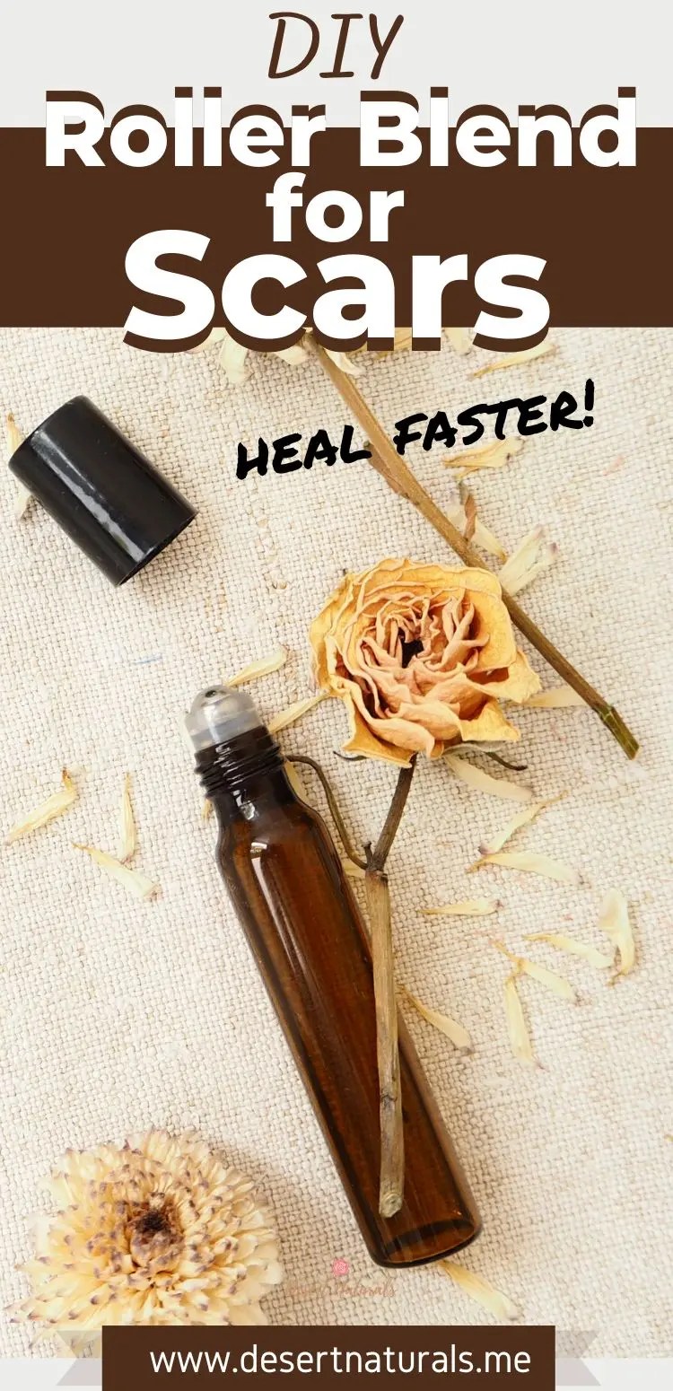 Best Essential Oils For Scars + DIY Healing Scar Roller Blend