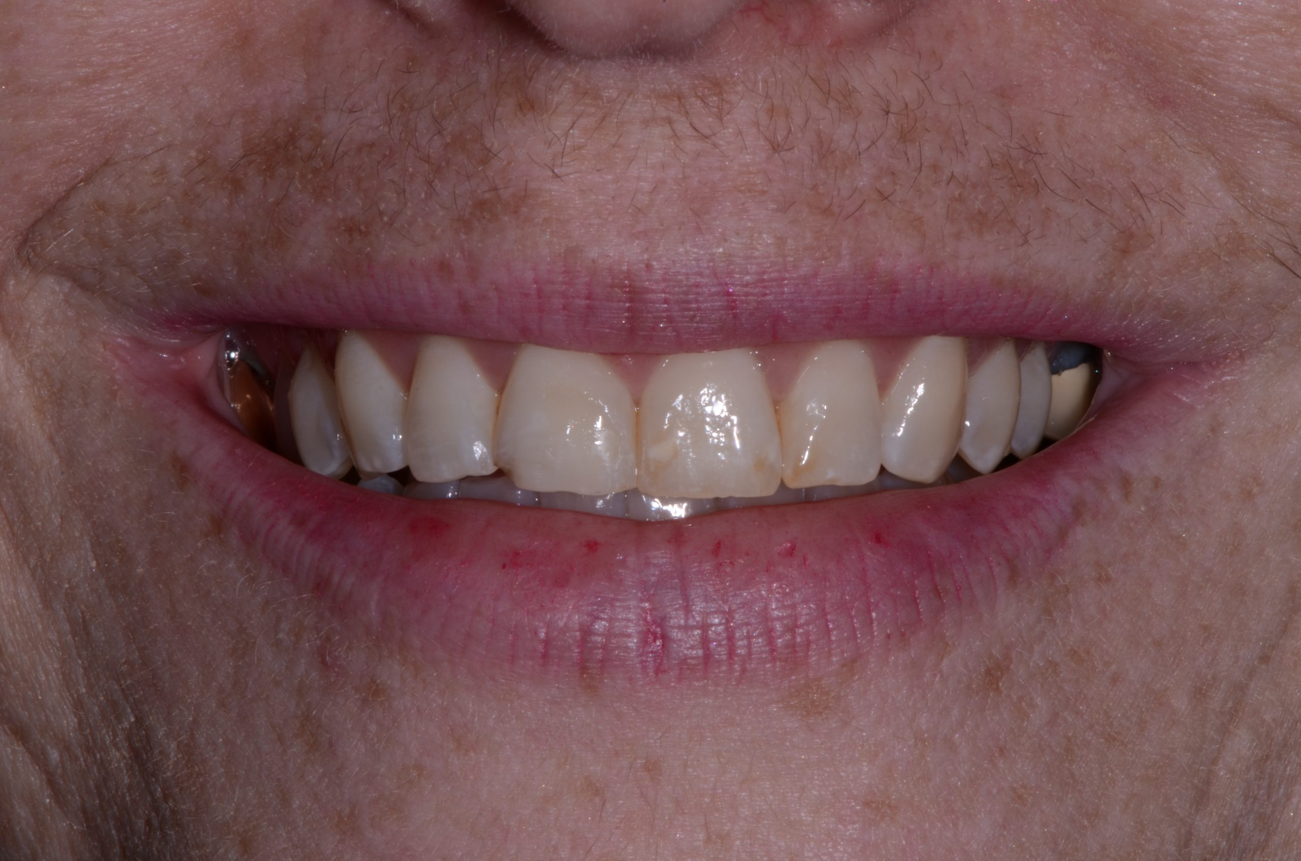 Cosmetic Dentistry Albuquerque Cosmetic Dentist Albuquerque
