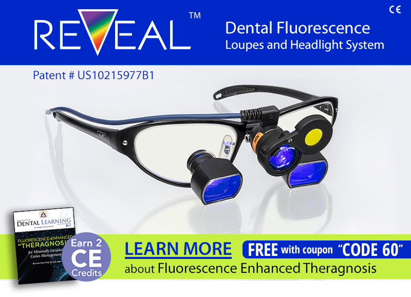 REVEAL Dental Fluorescence Loupes and Headlight System