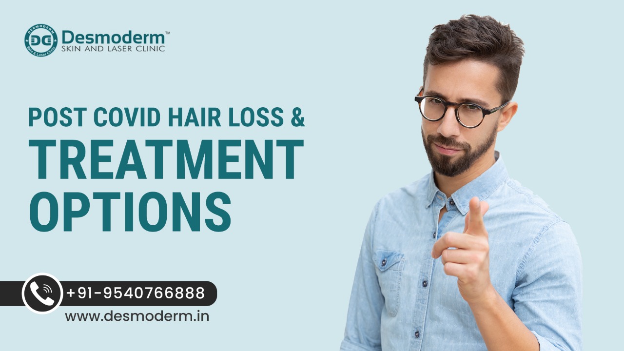 Post Covid Hair Loss and Treatments Desmoderm