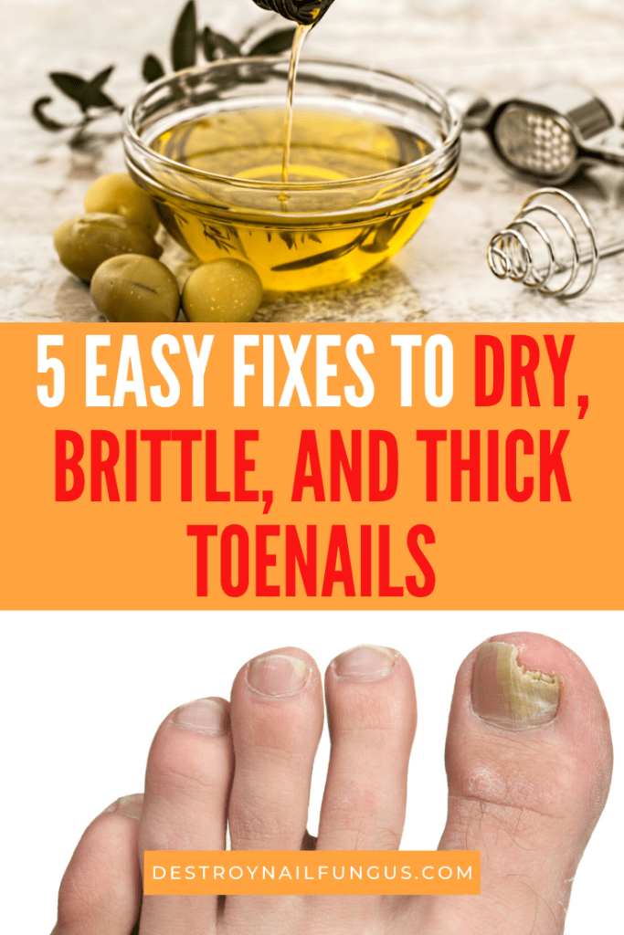 5 Easy And Effective Tips On How To Get Rid Of Dry Toenails