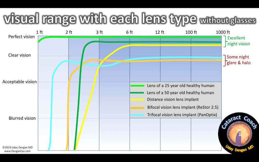 The Alcon PanOptix Trifocal Lens Implant Devgan Eye Surgery