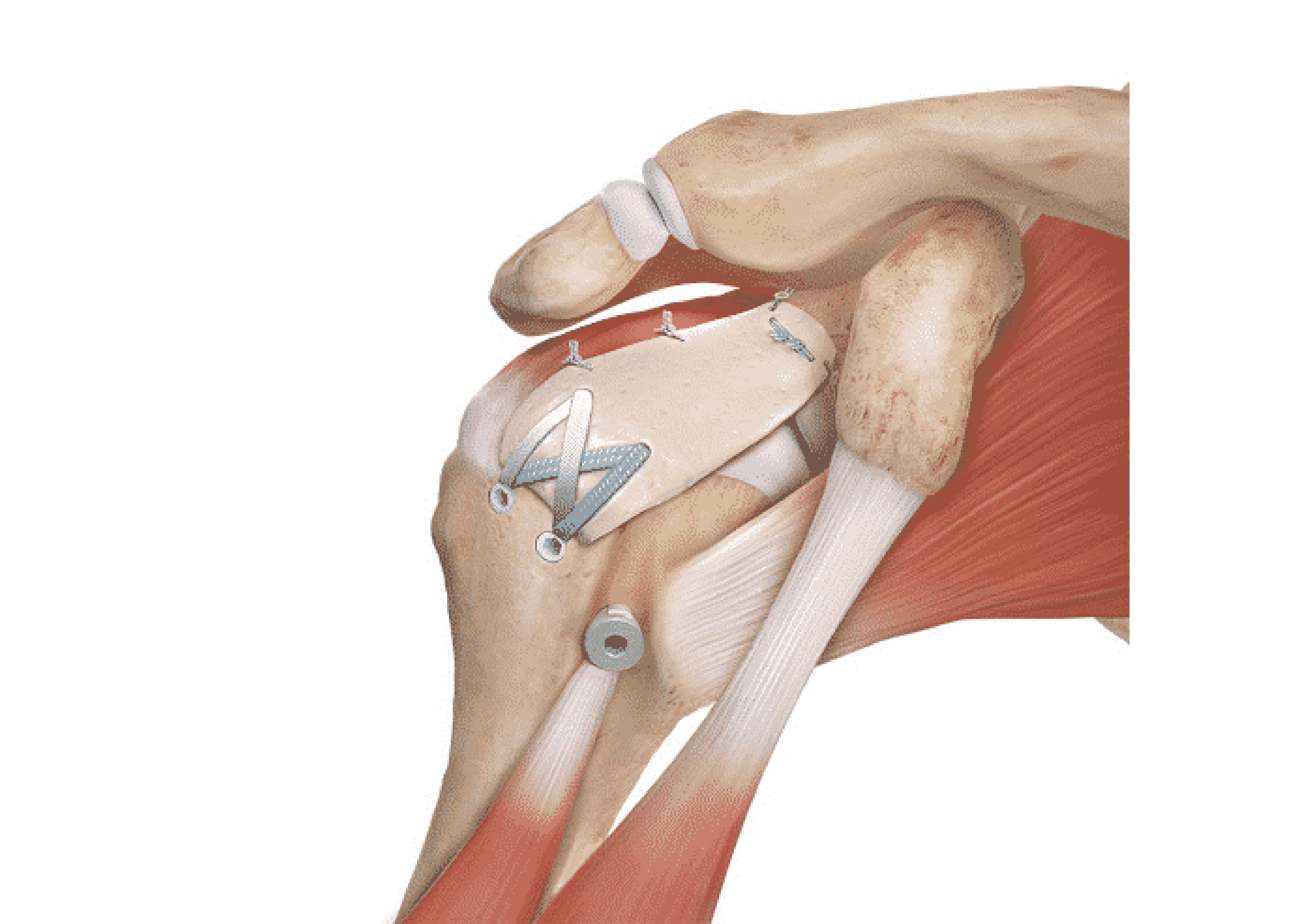 Treatment Vedaant Orthopedic Centre Dr. Dev Padia