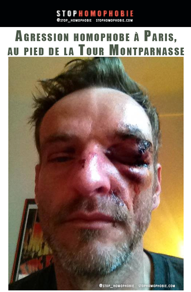 France Recrudescence des agressions homophobes