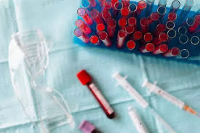 Exame de sangue pode indicar risco de quadro grave de covid