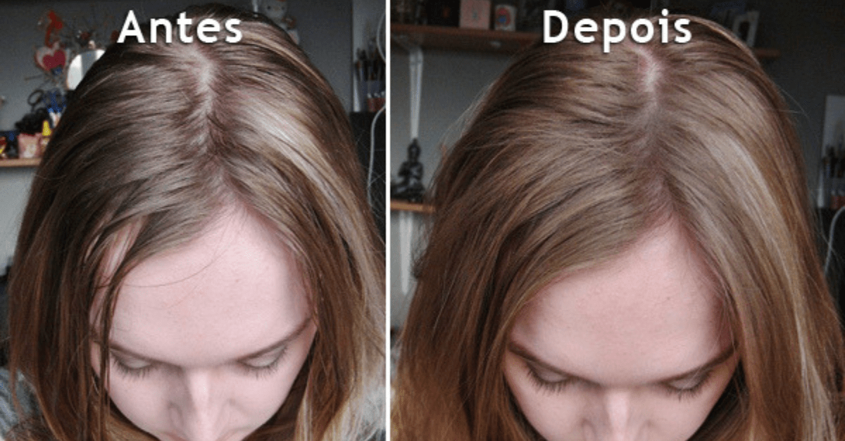 Como tirar oleosidade do cabelo em 7 dicas