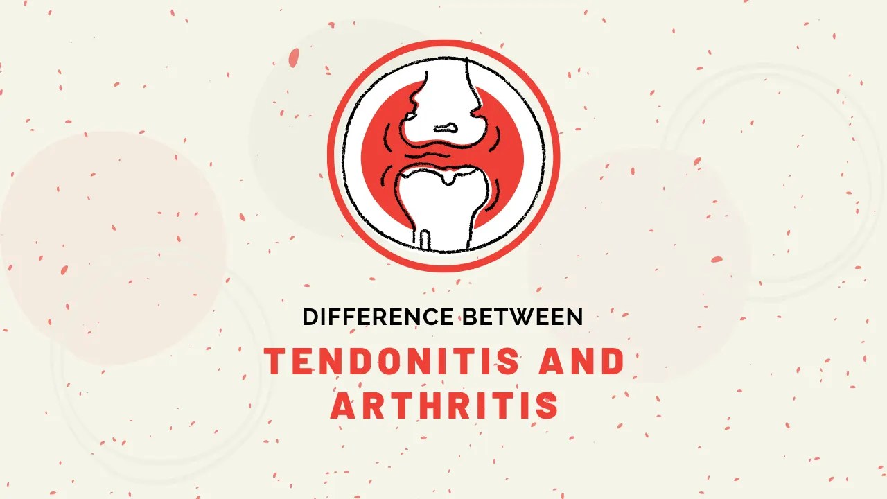 Difference Between Tendonitis and Arthritis Difference Between
