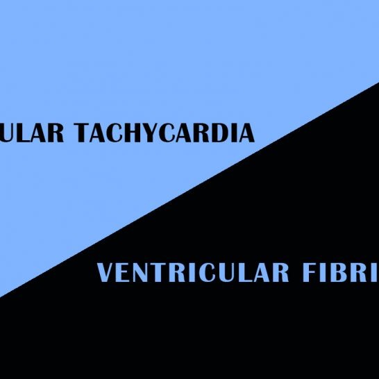 Difference Between Hulu and Hulu Live Difference Between