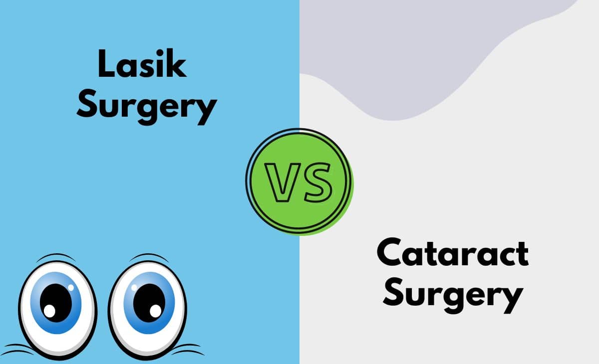 Lasik vs. Cataract Surgery What's The Difference (With Table)