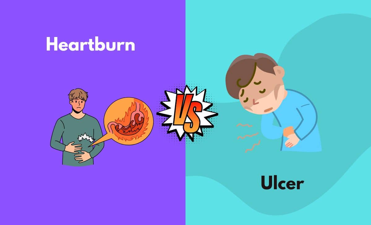 Heartburn vs. Ulcer What's The Difference (With Table)