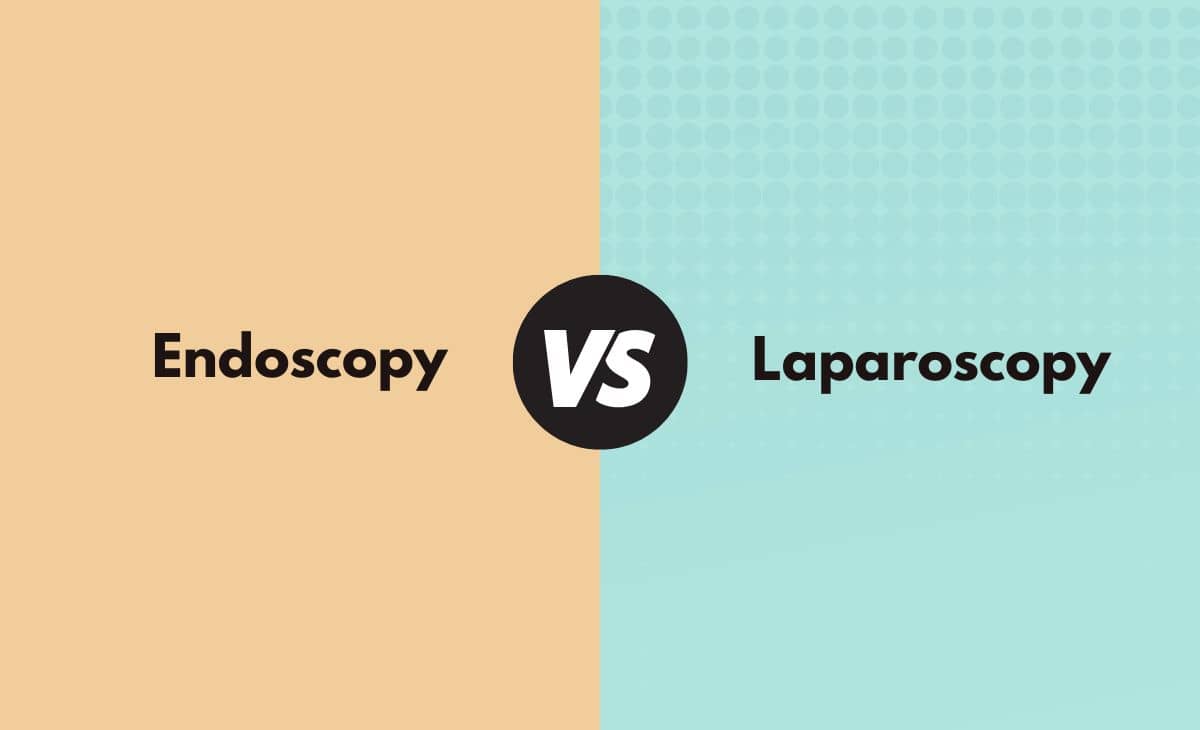 Endoscopy vs. Laparoscopy What's the Difference (With Table)