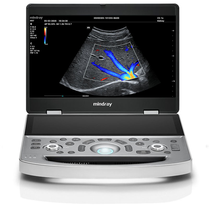 Mindray MX7 ¡Nuevo Producto! Digimed Ultrasonido