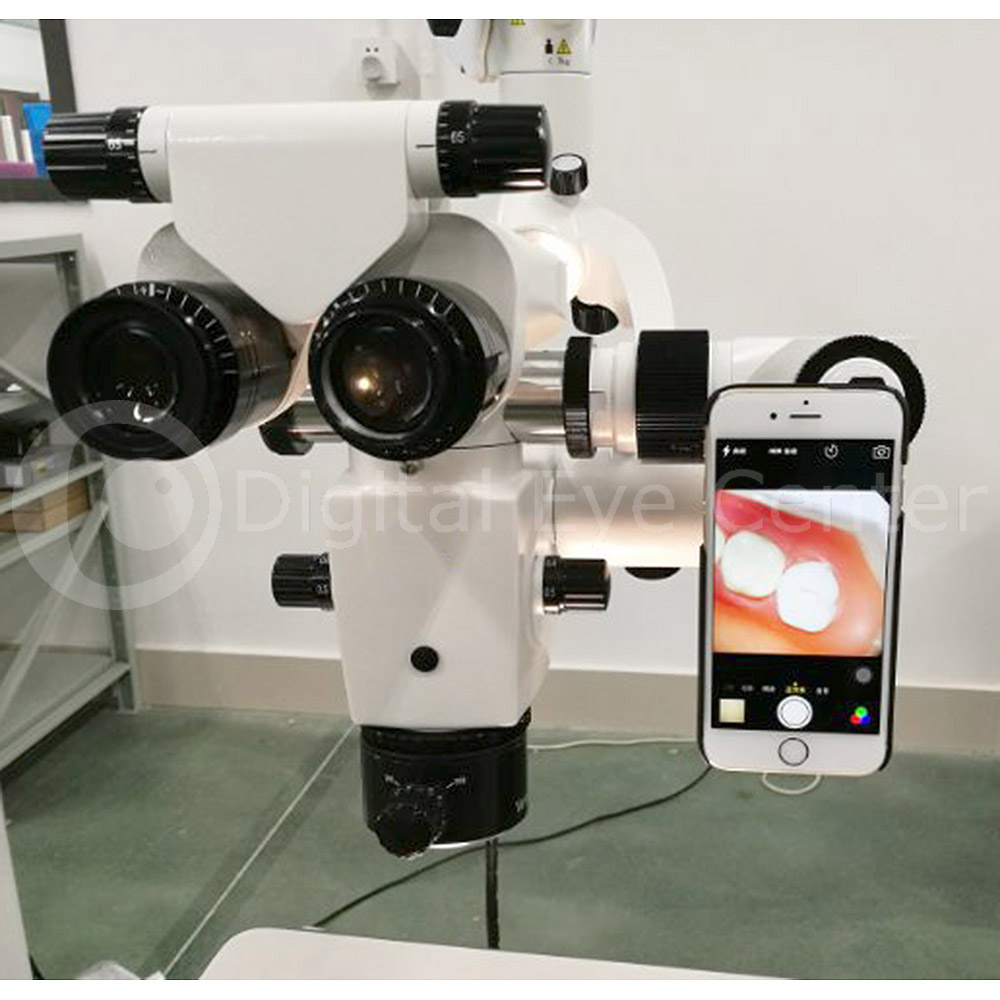 Microscope Smartphone Adapter Digital Eye Center