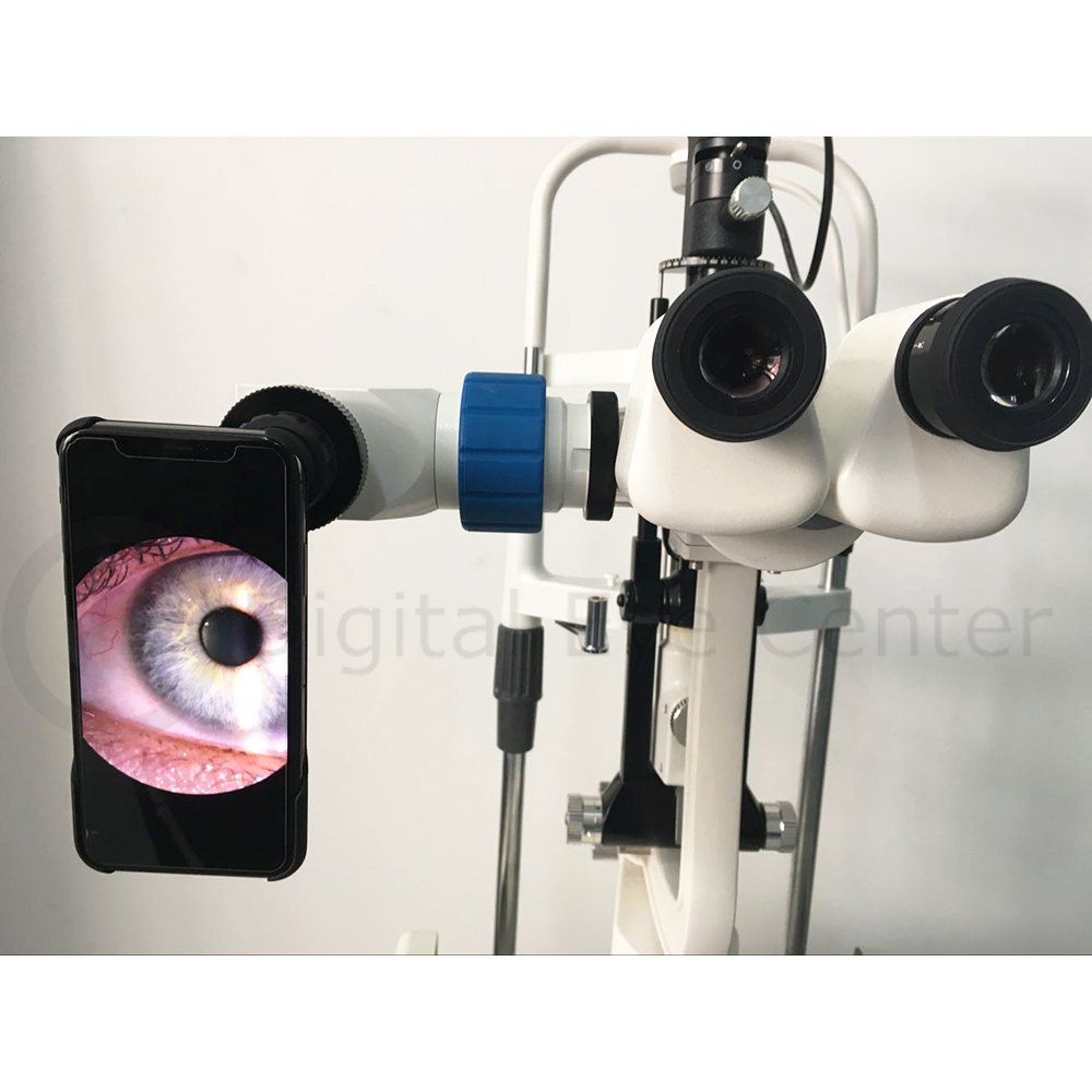 Microscope Smartphone Adapter Digital Eye Center