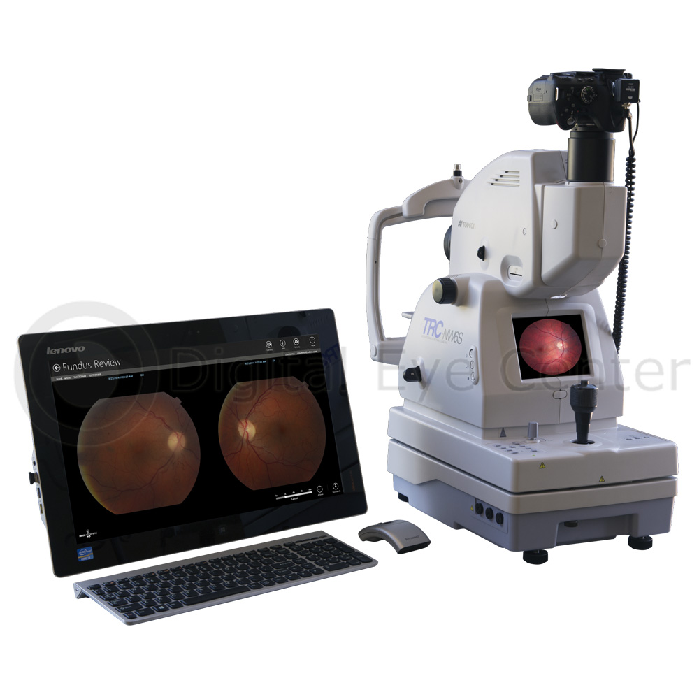 Fundus Camera CloudCAM Kit Retinal Camera, Non Mydriatic Fundus Camera