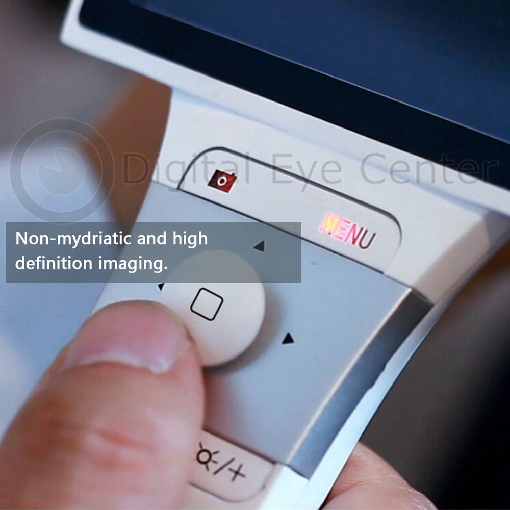 Portable Fundus Camera 2 mpx, Manual Focusing