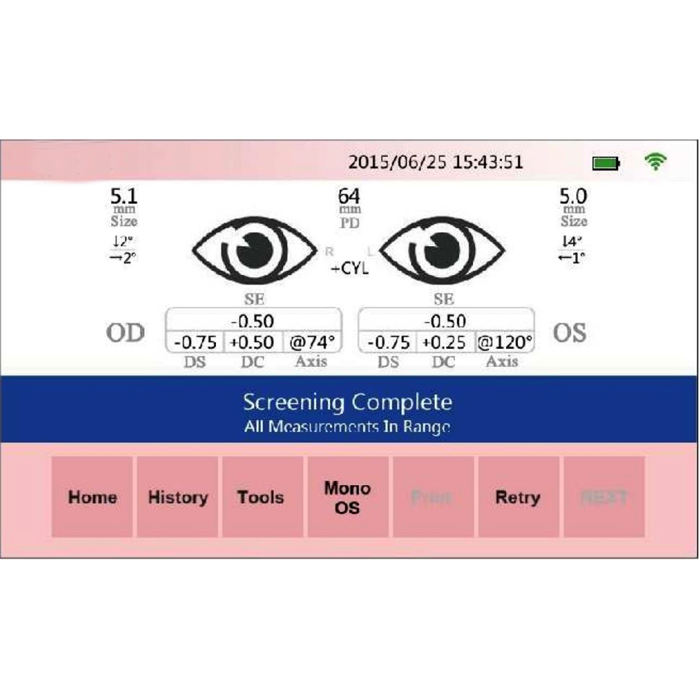 Vision Screener Digital Eye Pediatric Refractor Digital Eye Center