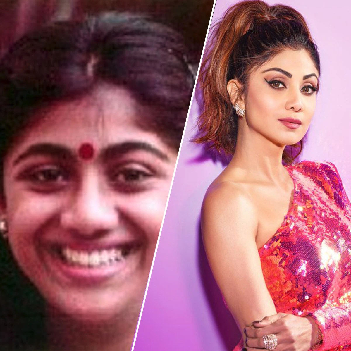 Bollywood Actors Before And After Plastic Surgery Shocking