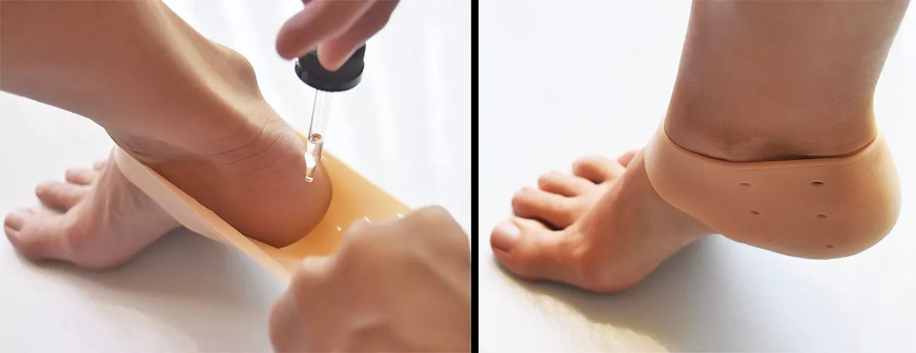 Deep Heel Itching What Causes It and How to Heal It