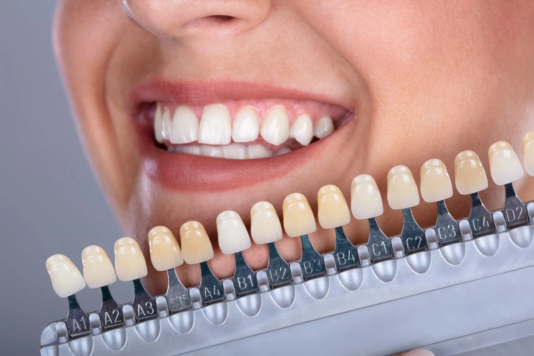 Will My Dental Crown Match the Color of My Teeth? Distinctive Dental