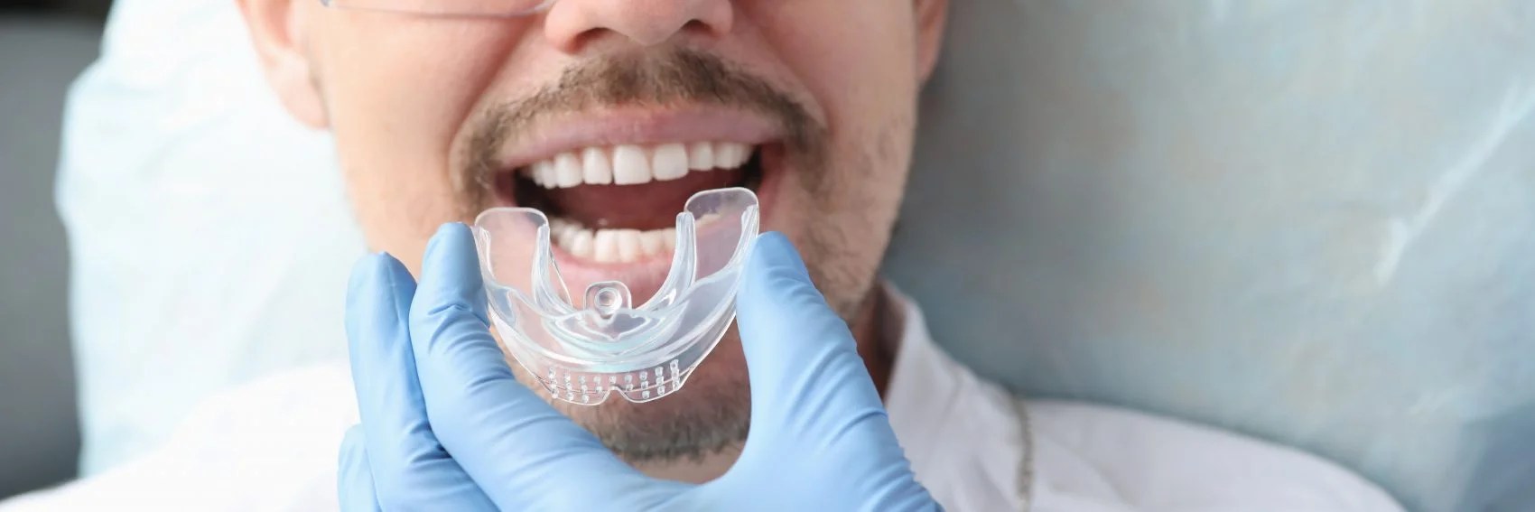 Why Oral Appliance Therapy Is So Popular Distinctive Dental Dental Oral Appliance Schererville