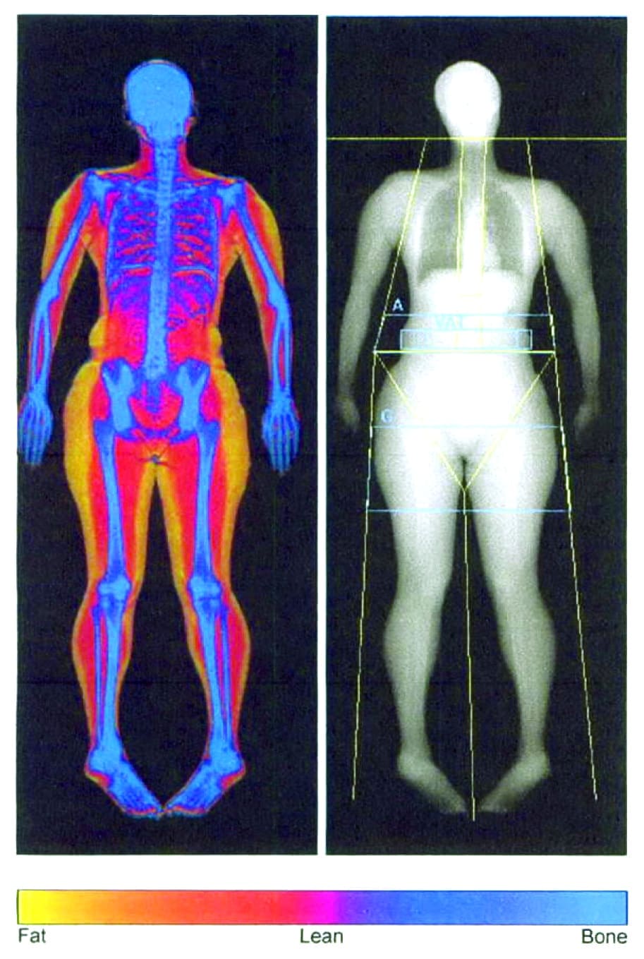 Give yourself the power of information body composition analysis at