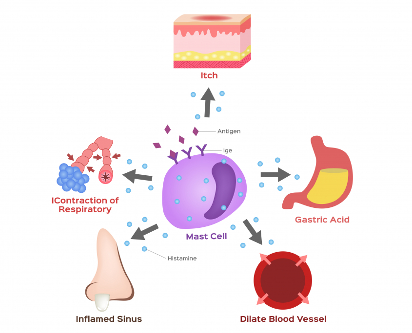 Histamine Intolerance Everything You Need to Know Dr. Robert Kiltz