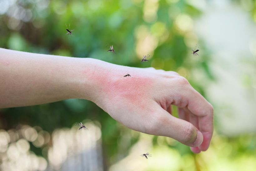 Prevent Mosquito Bites Naturally Doctor Solve