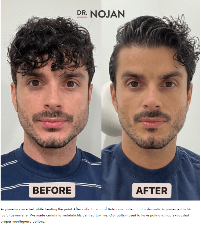 Botox Dr Nojan Bakhtiari TMJ, Oral and Facial Pain Specialist