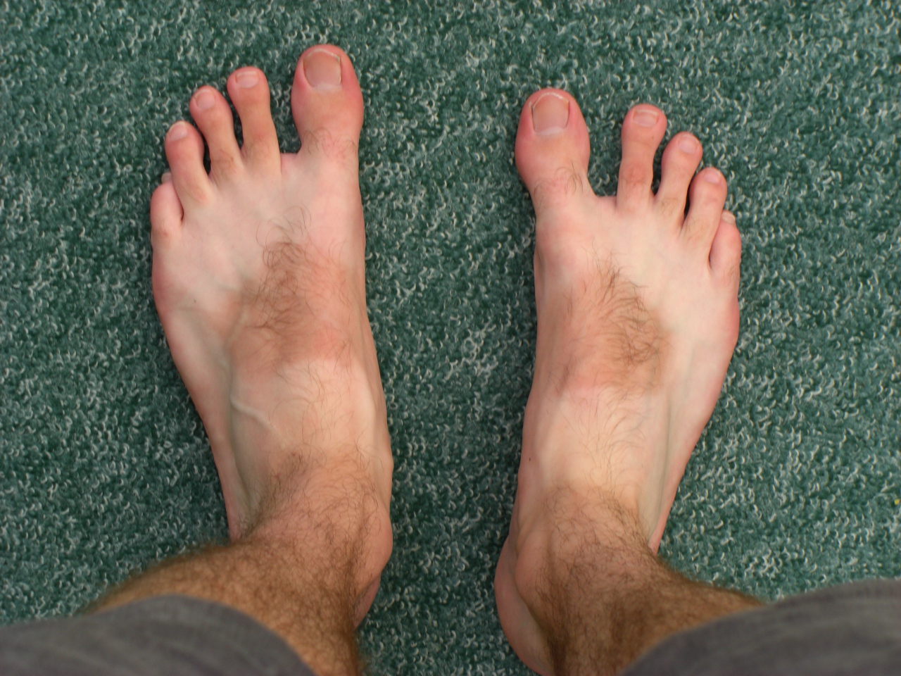 Foot disease doof.me.uk