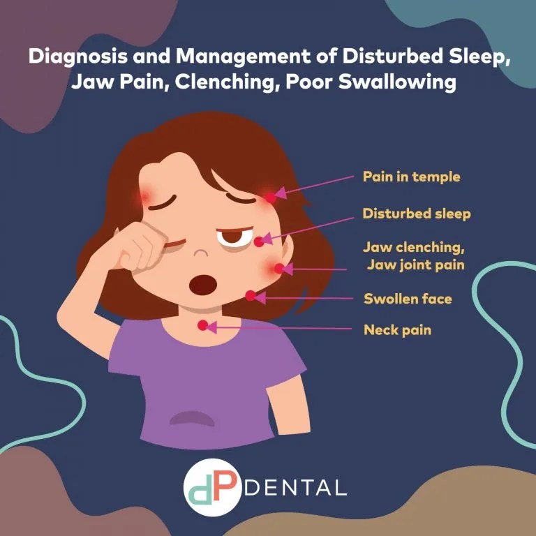 TMD Case Study 3 Management of Disturbed Sleep, Jaw Pain, Clenching
