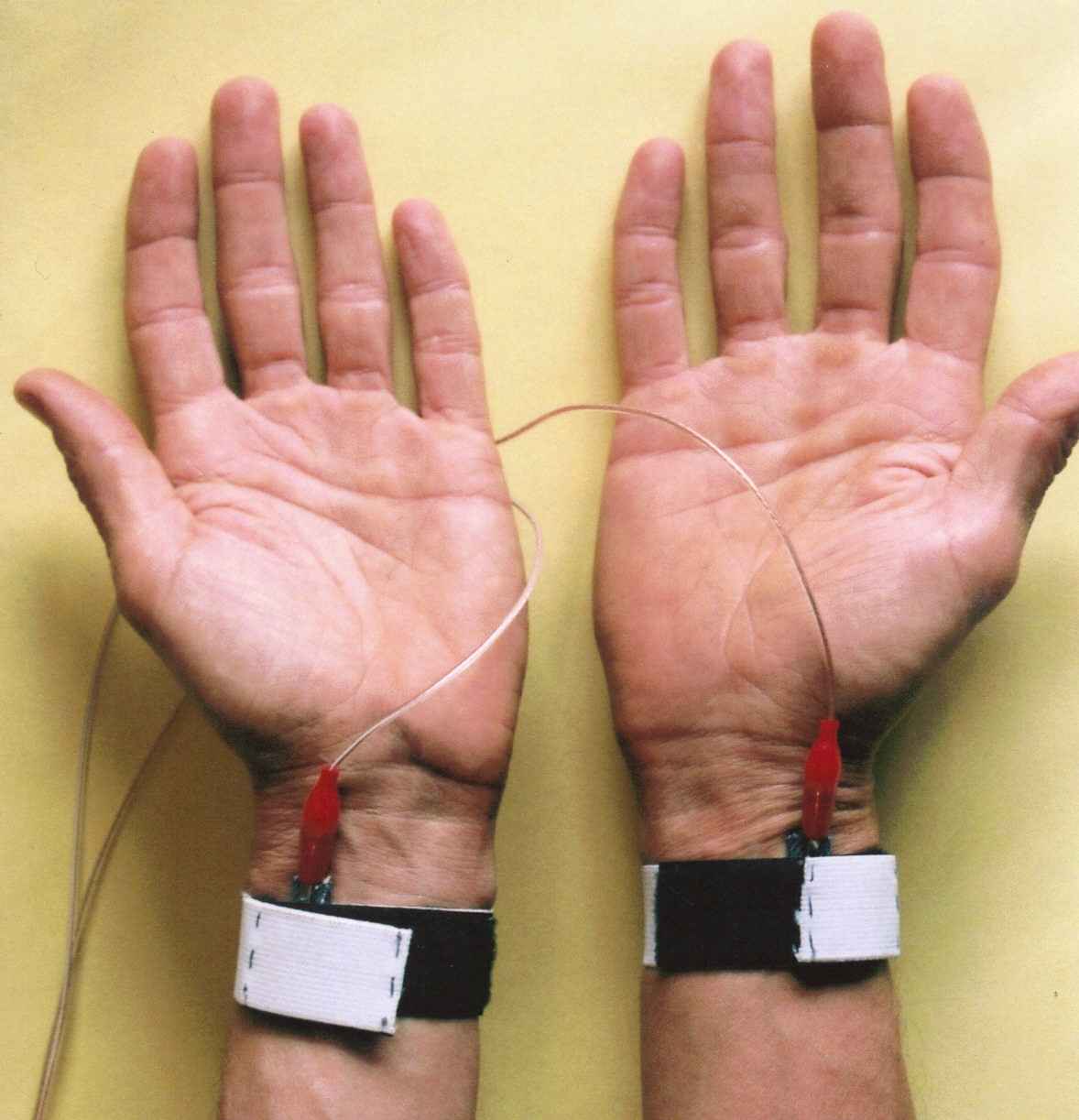 Concerning placement of wrist electrodes