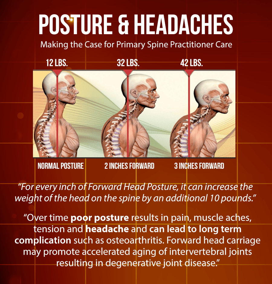 Headaches & Treatments Archives El Paso Back Clinic