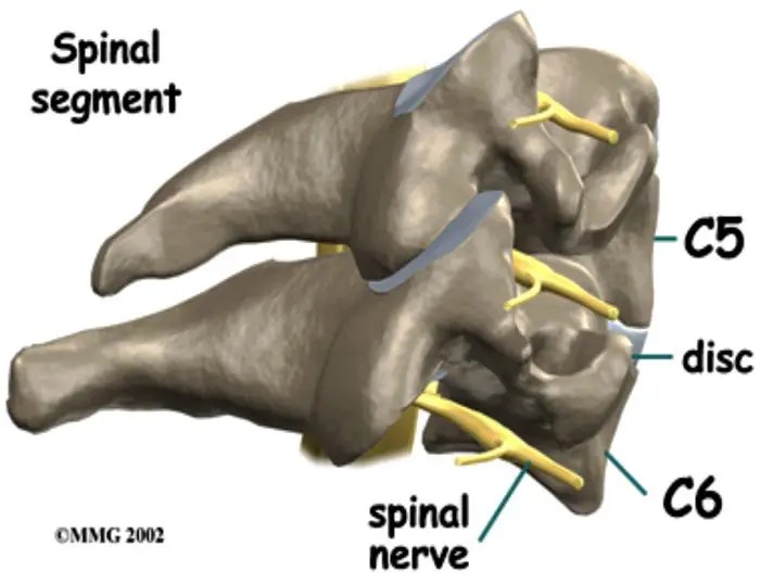 Radikulopathie? Was ist es? | El Paso, TX Arzt für Chiropraktik