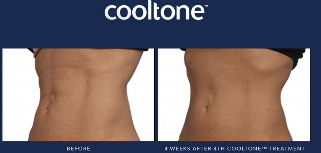 Blog Anna Avaliani MD Cosmetic & Laser Surgery Anna Avaliani MD