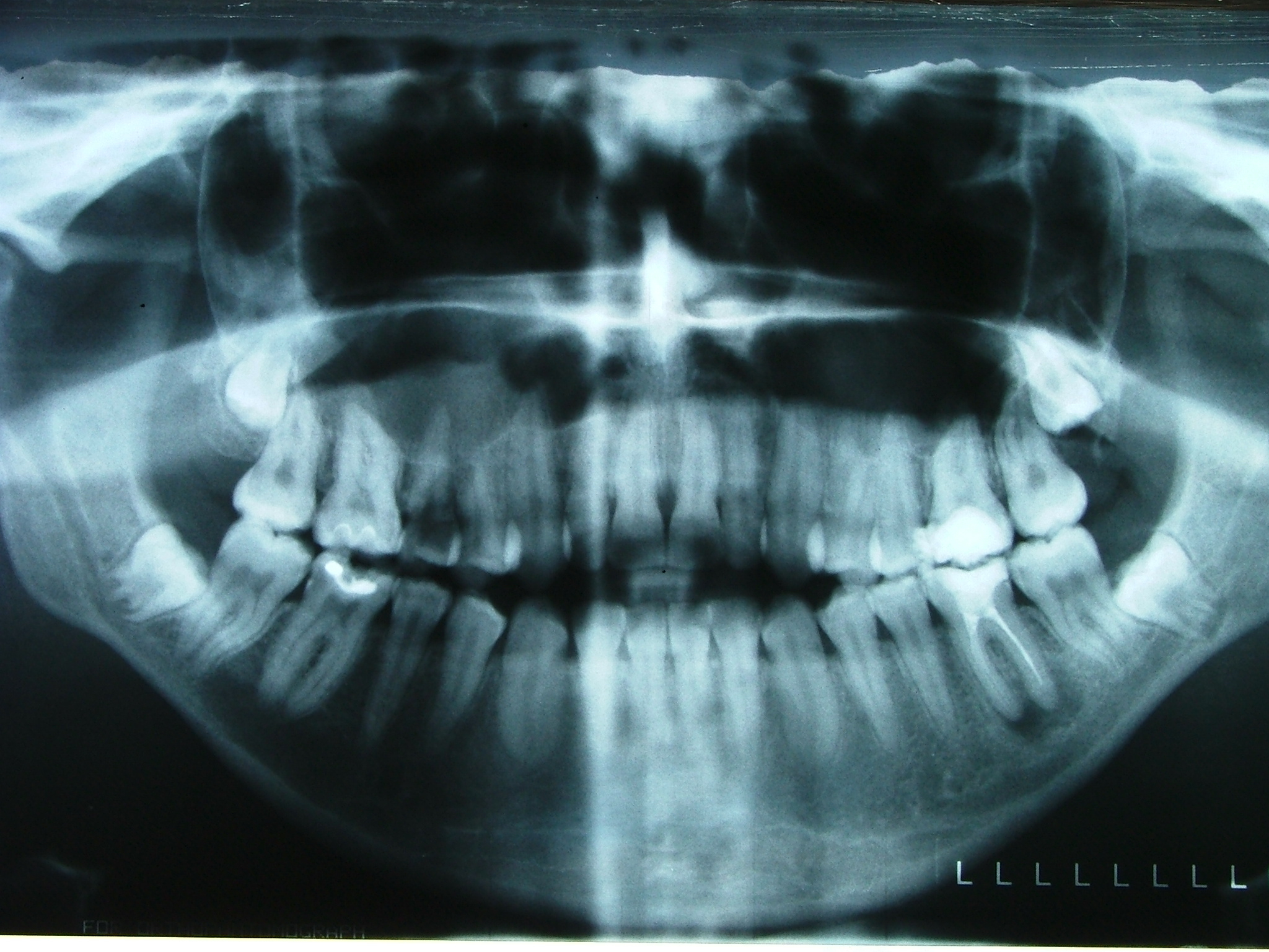 Let’s Rewind… Brampton Dentist Dr. Robert Axelrad