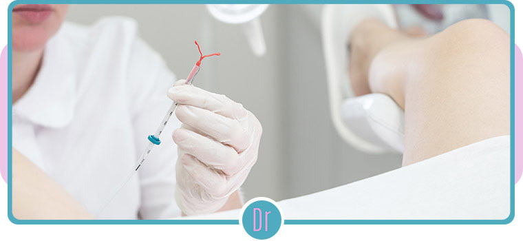 IUD Insertion and Removal Procedure Near Me in Eugene, OR