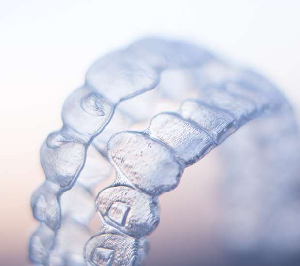 ClearCorrect Braces Houston, TX Bruce Matson, DDS Nearly Invisible