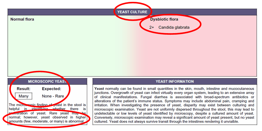 How to Get Properly Tested for Yeast Infection?