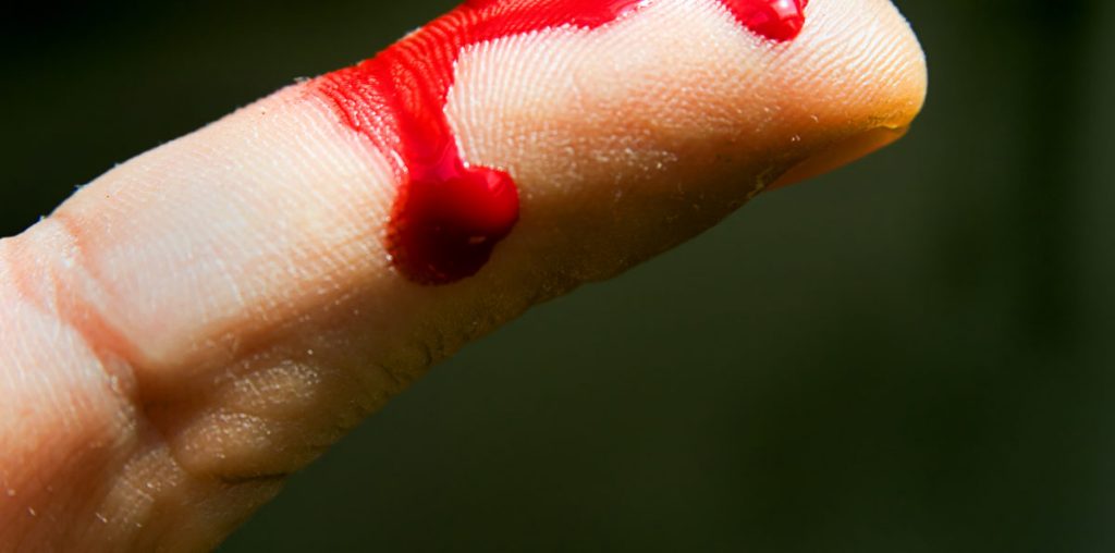 Dream about Someone Bleeding DreamsDirectory