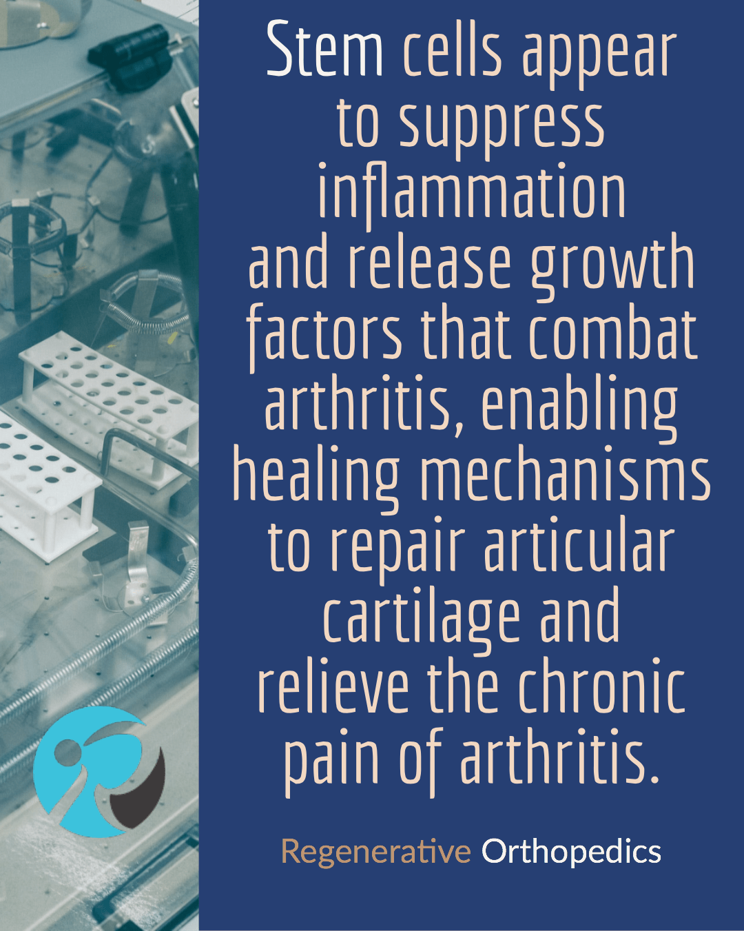 Stem Cell Treatment Los Angeles Alternative To Joint Replacement