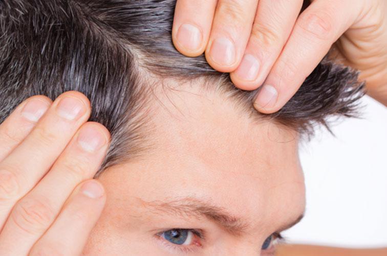 Understanding NeoGraft® for Hair Loss Dr. Brennan