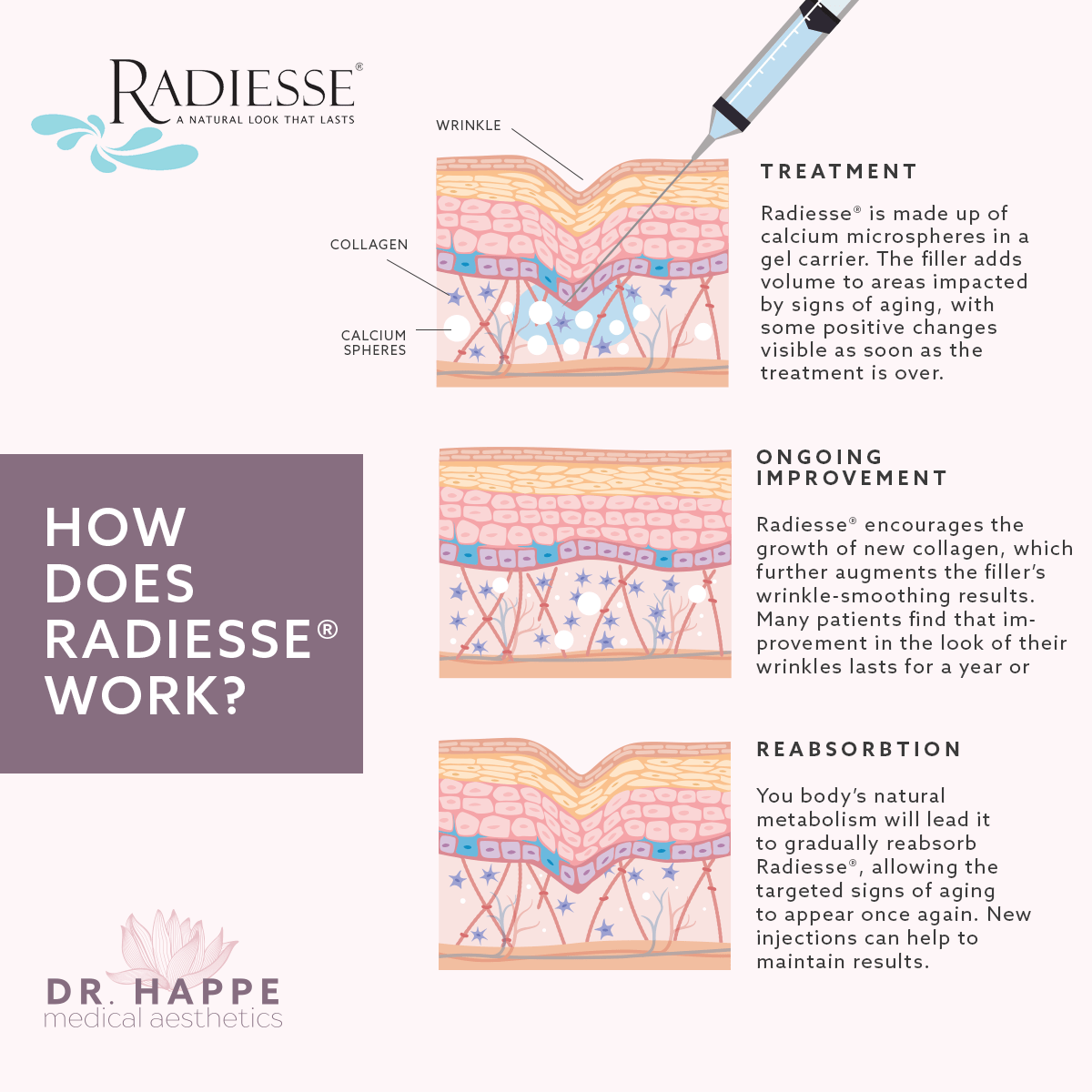 Radiesse for Hands and Face Boston Dr. Holly Happe
