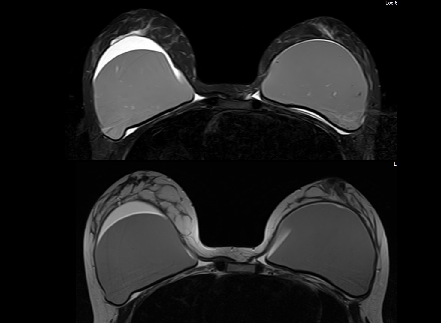 MRI Scan Dubai Radiology Center Same Day MRI