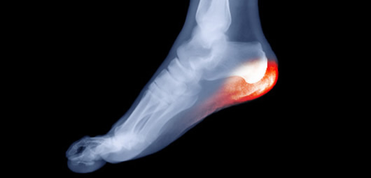 Encinitas Podiatry Group Encinitas, CA Podiatry San Diego Podiatry