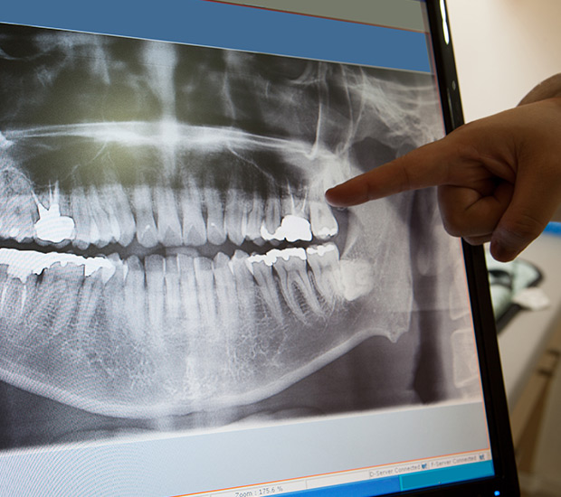 3D Imaging Platte Valley Oral Surgery Denver, CO