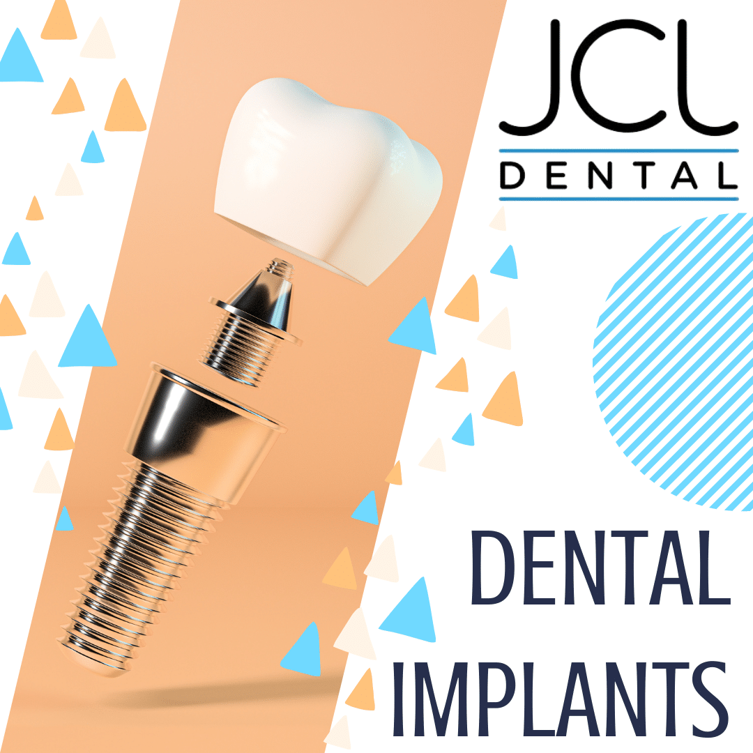 Upper East Side Dental Implants Cosmetic Dentist Manhattan