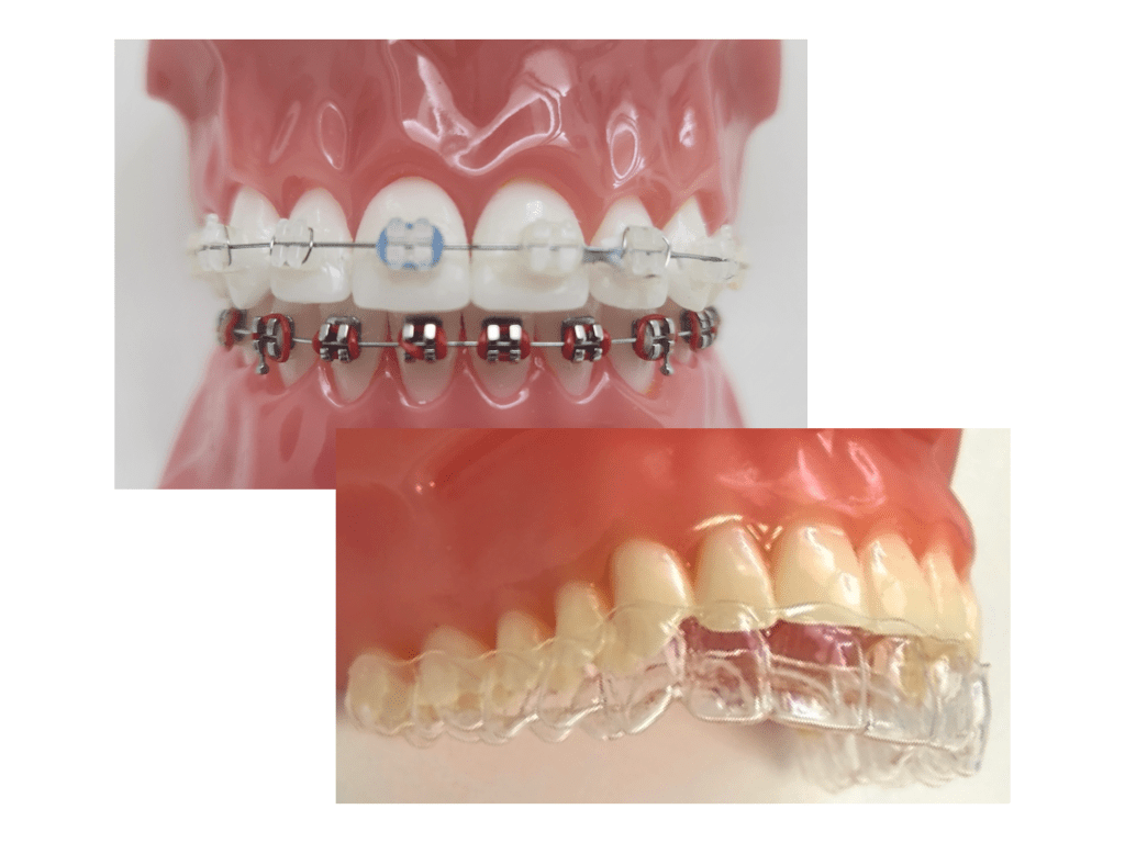 Orthodontic Services in Norwalk & Bridgeport, CT A+ Dental