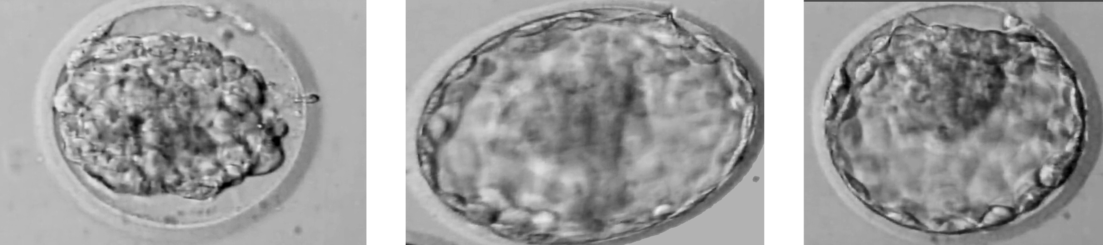 Everything you need to know about Freezing and Thawing of Embryos.