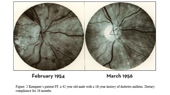 Walter Kempner, MD - Founder of the Rice Diet - Dr. McDougall